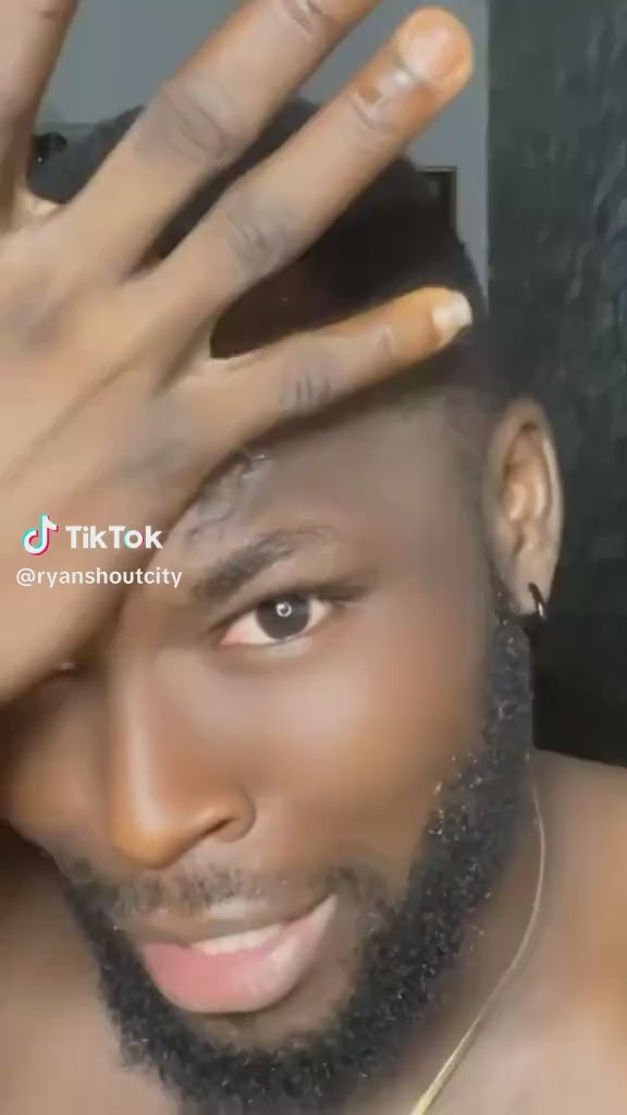 MINOXIDIL